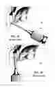 Fig. 07 - Dental screwdriver
