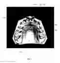 Fig. 05 - Tooth modeling system
