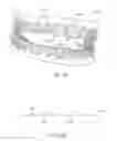 Fig. 09 - Three-dimensional printed dental appliances using support structures