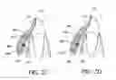 Fig. 05 - ORTHODONTIC ASSEMBLY