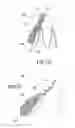 Fig. 06 - ORTHODONTIC ASSEMBLY