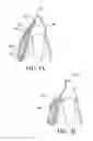 Fig. 07 - ORTHODONTIC ASSEMBLY