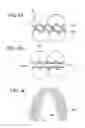 Fig. 08 - ORTHODONTIC ASSEMBLY