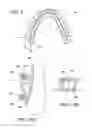 Fig. 14 - ORTHODONTIC ASSEMBLY
