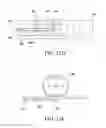Fig. 16 - ORTHODONTIC ASSEMBLY
