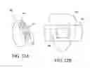 Fig. 17 - ORTHODONTIC ASSEMBLY