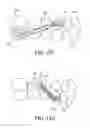 Fig. 19 - ORTHODONTIC ASSEMBLY