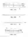 Fig. 21 - ORTHODONTIC ASSEMBLY