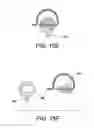 Fig. 22 - ORTHODONTIC ASSEMBLY
