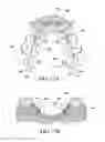 Fig. 26 - ORTHODONTIC ASSEMBLY
