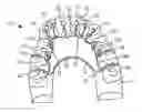 Fig. 01 - Lingual orthodontic appliance with removable section