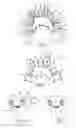 Fig. 02 - Lingual orthodontic appliance with removable section