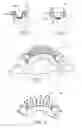 Fig. 03 - Lingual orthodontic appliance with removable section
