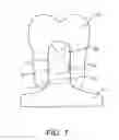 Fig. 07 - Dental Framework