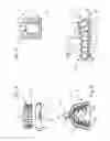 Fig. 03 - IMPRESSION TRAY, AND METHOD FOR CAPTURING STRUCTURES, ARRANGEMENTS OR SHAPES, IN PARTICULAR IN THE MOUTH OR HUMAN BODY