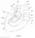 Fig. 06 - Method for manipulating a dental virtual model, method for creating physical entities based on a dental virtual model thus manipulated, and dental models thus created