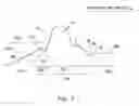 Fig. 07 - Method for manipulating a dental virtual model, method for creating physical entities based on a dental virtual model thus manipulated, and dental models thus created
