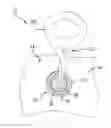Fig. 01 - Medical device having removable deployment device and affixation element