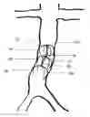 Fig. 01 - Tiltable implantable medical device