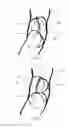 Fig. 04 - Tiltable implantable medical device