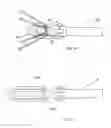 Fig. 11 - Methods of self-aligning stent grafts