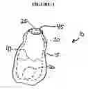 Fig. 05 - IMPLANT INSERTION DEVICE AND METHOD OF USE THEREOF
