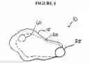Fig. 07 - IMPLANT INSERTION DEVICE AND METHOD OF USE THEREOF