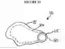 Fig. 16 - IMPLANT INSERTION DEVICE AND METHOD OF USE THEREOF