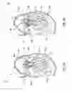 Fig. 03 - Heart valves prostheses and methods for percutaneous heart valve replacement