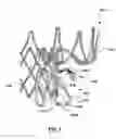 Fig. 12 - Heart valves prostheses and methods for percutaneous heart valve replacement
