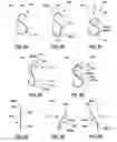 Fig. 13 - Heart valves prostheses and methods for percutaneous heart valve replacement
