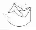 Fig. 01 - METHOD FOR THICKNESS CONTROL AND THREE-DIMENSIONAL SHAPING OF BIOLOGICAL TISSUE DURING FIXING