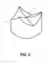 Fig. 03 - METHOD FOR THICKNESS CONTROL AND THREE-DIMENSIONAL SHAPING OF BIOLOGICAL TISSUE DURING FIXING