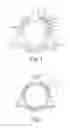Fig. 02 - Stents for prosthetic heart valves and methods of making same