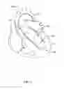 Fig. 02 - Medical guidewire