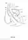 Fig. 06 - Medical guidewire