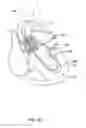 Fig. 07 - Medical guidewire