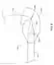 Fig. 11 - Medical guidewire