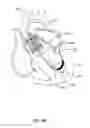 Fig. 13 - Medical guidewire