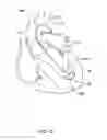 Fig. 14 - Medical guidewire