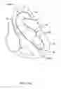 Fig. 15 - Medical guidewire