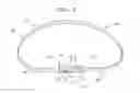 Fig. 04 - Actively-engageable movement-restriction mechanism for use with an annuloplasty structure