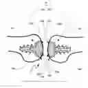 Fig. 01 - System and method for repairing articular surfaces