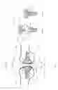 Fig. 02 - System and method for repairing articular surfaces