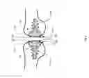 Fig. 06 - System and method for repairing articular surfaces