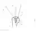 Fig. 12 - System and method for repairing articular surfaces