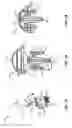 Fig. 24 - System and method for repairing articular surfaces