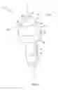 Fig. 02 - Temporomandibular joint implants and methods of treating a temporomandibular joint