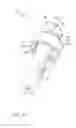 Fig. 03 - Temporomandibular joint implants and methods of treating a temporomandibular joint