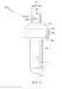 Fig. 05 - Temporomandibular joint implants and methods of treating a temporomandibular joint